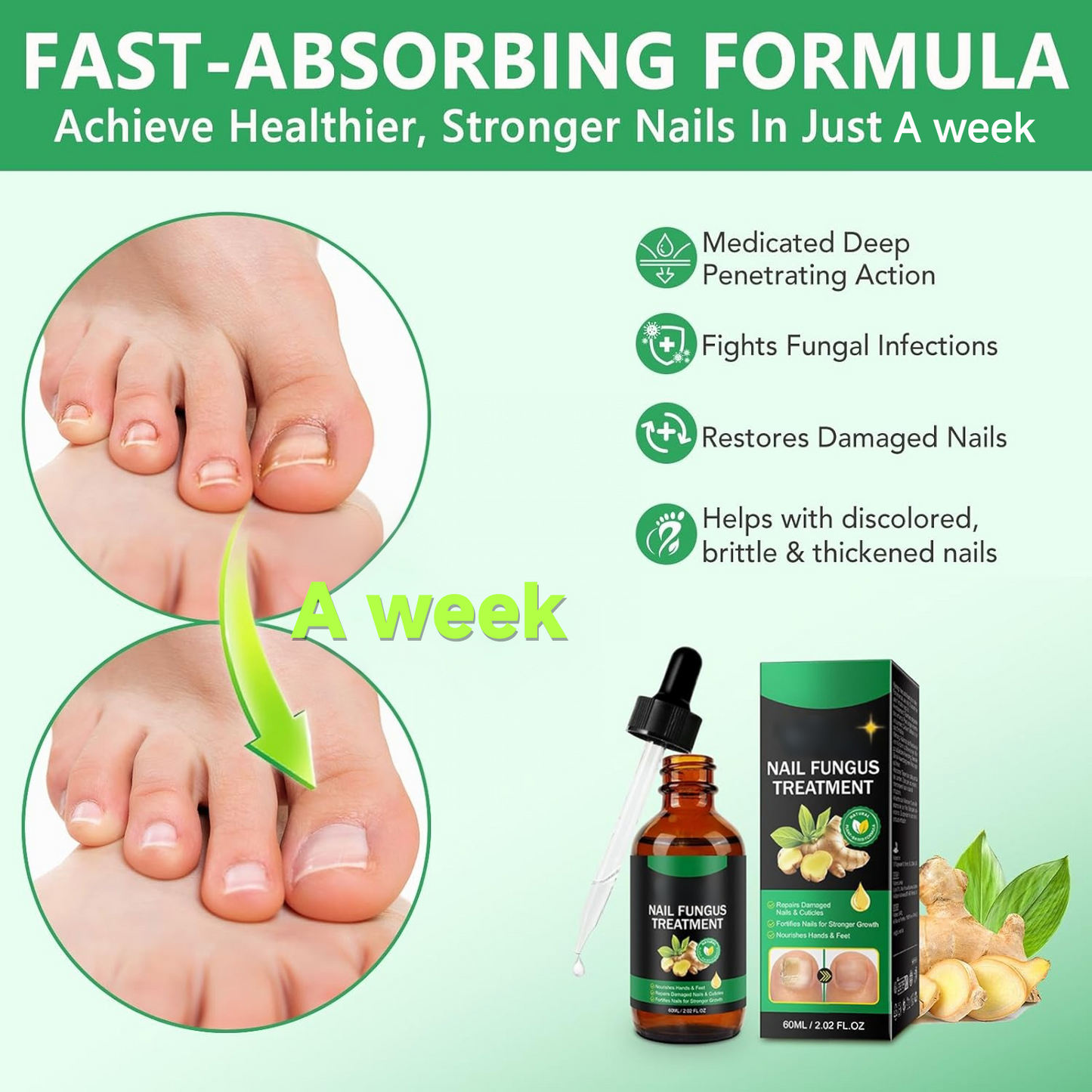 A Week Anti-Fungal Treatment, 100% Natural