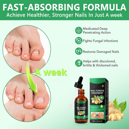 A Week Anti-Fungal Treatment, 100% Natural